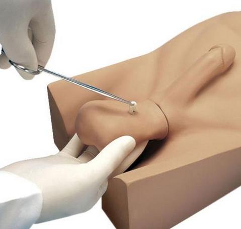 张掖“康为医疗”新型输精管切除术（NSV）训练操作模型