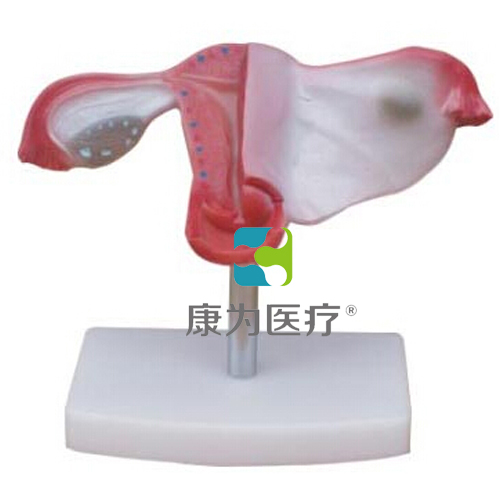 庆阳“康为医疗”自然大子宫解剖模型