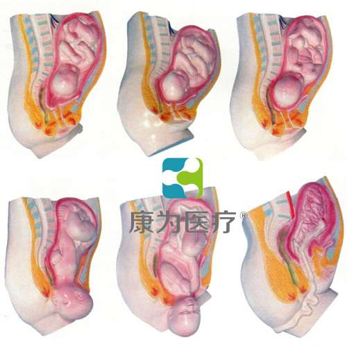 “康为医疗”足月胎儿分娩过程模型