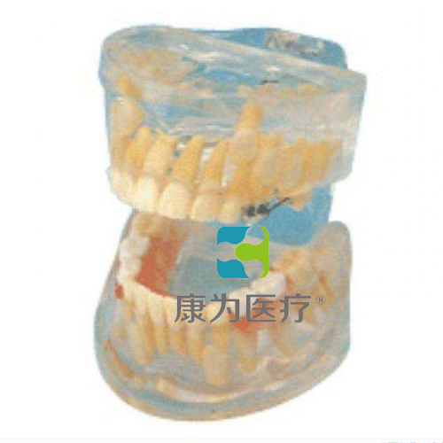 “康为医疗”透明乳牙发育模型(保隙装置模型)