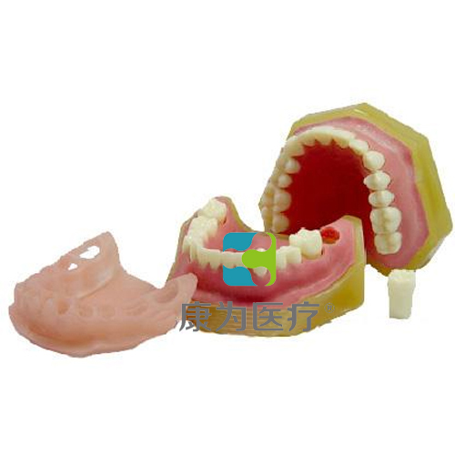 “康为医疗”标准牙颌模型C