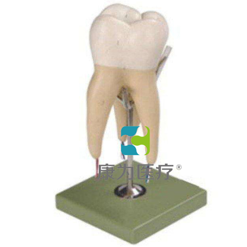 “康为医疗”磨牙有三个牙根模型